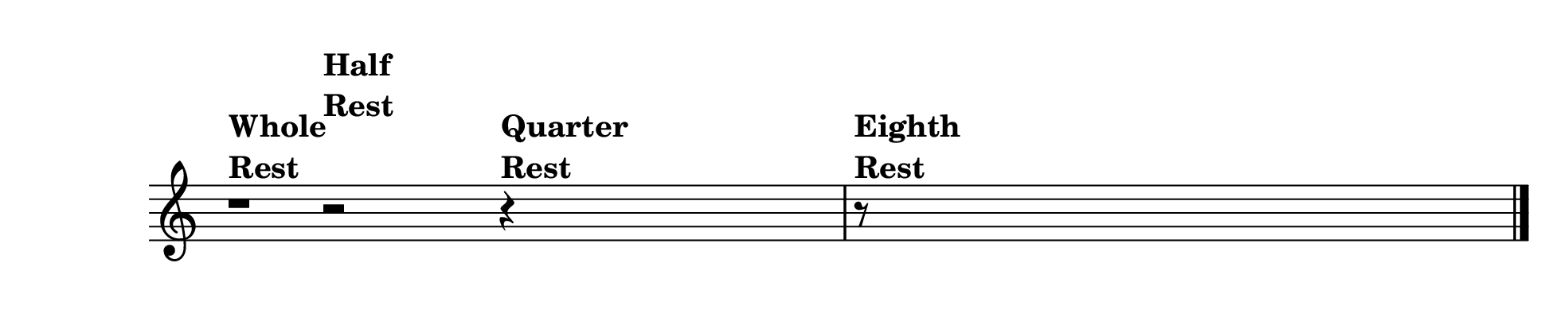 Rest symbols: silence has its own notation.